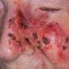 Malformation humaine et maladie rare