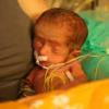 Malformation humaine et maladie rare