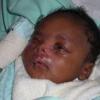 Malformation humaine et maladie rare