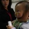Malformation humaine et maladie rare
