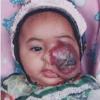 Malformation humaine et maladie rare
